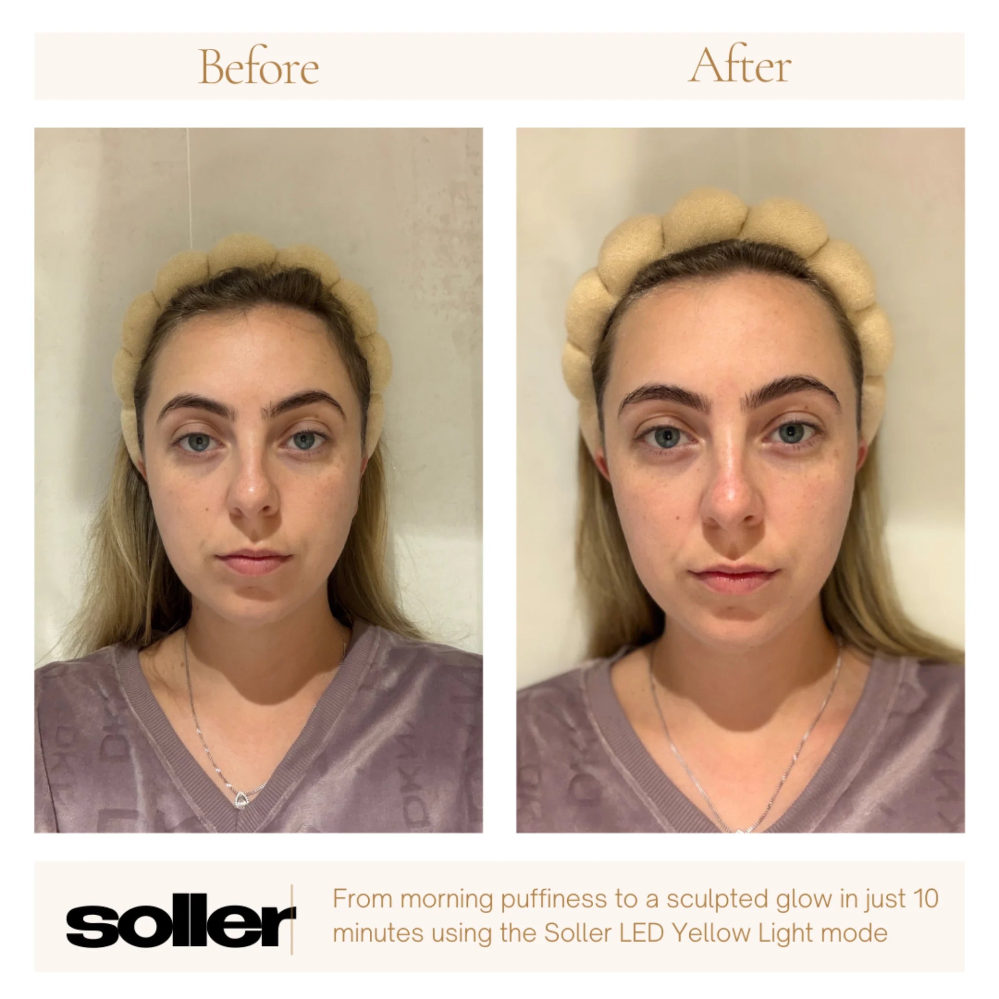 Soller Ultra Lite LED Face Mask